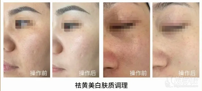中醫(yī)駐顏美療師研修課程